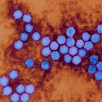 Polio Virus