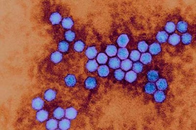 Polio Virus