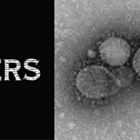 MERS Virus