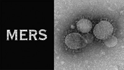 MERS Virus