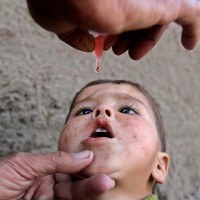 Polio Case