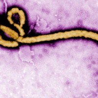 Ebola Virus