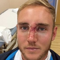 Stuart Broad