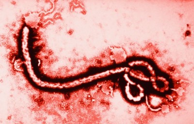 Ebola Virus