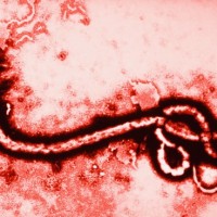 Ebola Virus