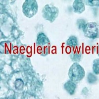 Neagleria