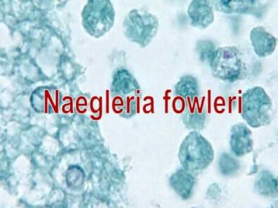 Neagleria