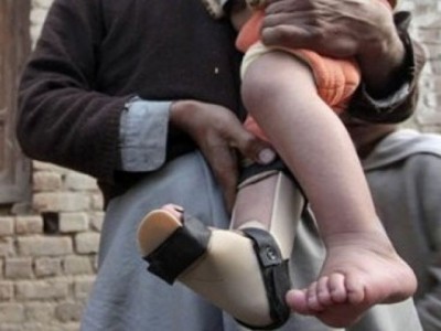 Peshawar Polio