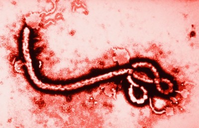 Ebola Virus