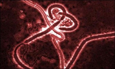 Ebola Virus