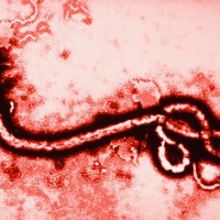 Ebola Virus