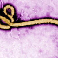 Ebola Virus