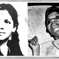 Aruna Shanbaug