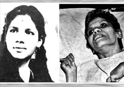 Aruna Shanbaug