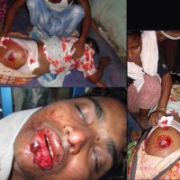 Muslim Children Were Burnt Alive In Meiktila - Burma