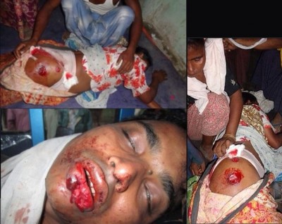 Muslim Children Were Burnt Alive In Meiktila – Burma