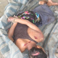 Tie-up and Killed of Rohingya