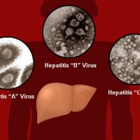 Hepatitis Viruses