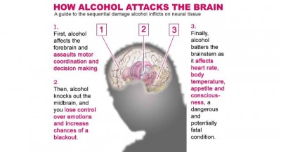 Alcohol Sid Effect