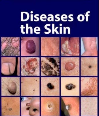 Skin Diseases