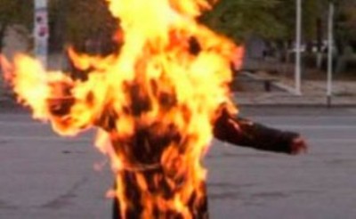 Muzaffargarh Girl Burns