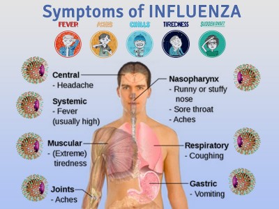 Influenza Symptoms