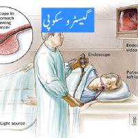 Gastroscopy