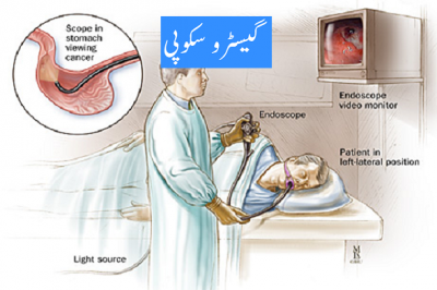 Gastroscopy