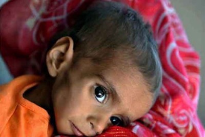 Tharparkar Child