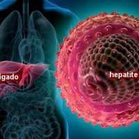 Hepatitis