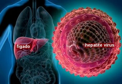 Hepatitis