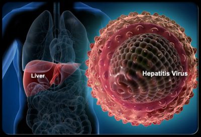 Hepatitis Disease