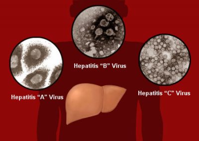 Hepatitis Viruses