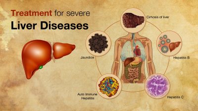 Liver Diseases