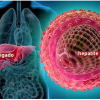 Hepatitis