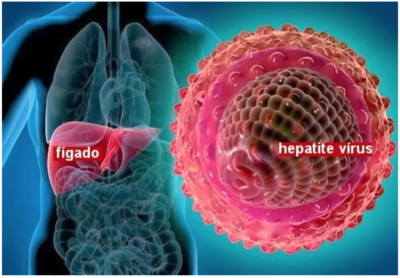 Hepatitis