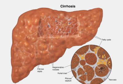 Liver