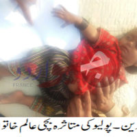 Badin Polio Case