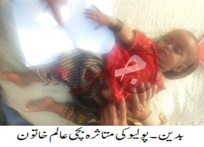 Badin Polio Case