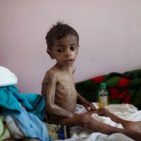 Yemen Food Shortage