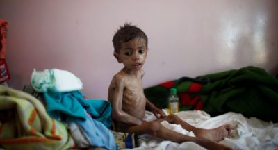 Yemen Food Shortage