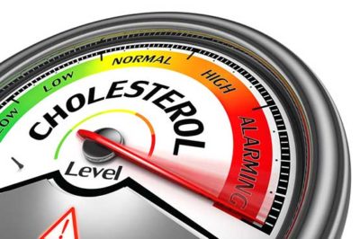 Cholesterol