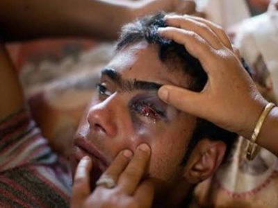 Kashmir Pellet Gun Victim