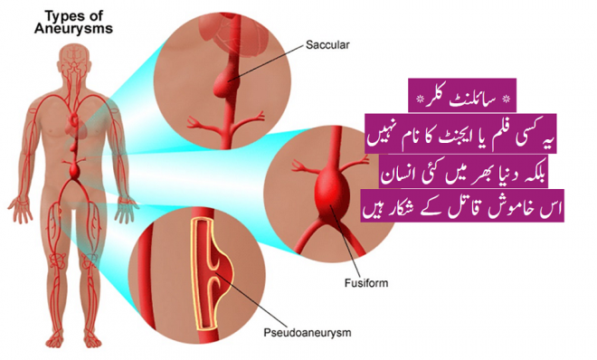 سائلنٹ کلر