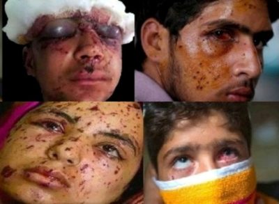 Kashmir Pellet Gun Victims