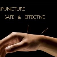 Acupuncture