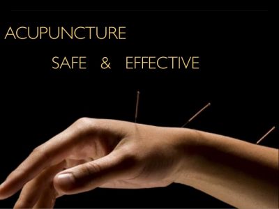 Acupuncture